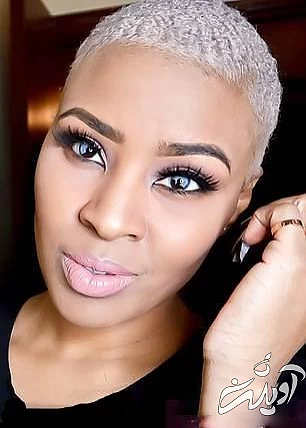 چشمان شگفت‌انگیز با اختلال ژنتیکی